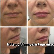 MediDerm, центр косметології та дерматології фото