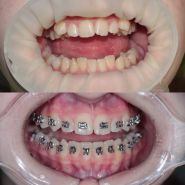 O Dent, стоматологія фото