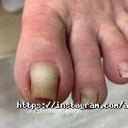 Подологічна практика Соломинської Анни фото