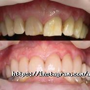 Альмадент, стоматологія фото