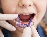 Good Dent Dental Clinic, стоматологія фото