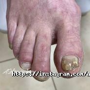 Подологічна практика Соломинської Анни фото