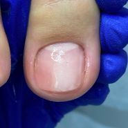 Подологічна практика Марини Єгоращенко фото