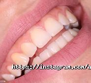 Альмадент, стоматологія фото