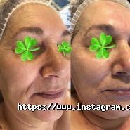 Clean Skin, косметологічний кабінет фото