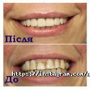 Академічна стоматологія на Дніпрельстанівська фото