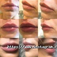 New Aesthetic, центр краси і здоров'я фото