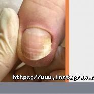 Stoppa, центр подології фото