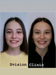 S.Vision, стоматологічна клініка фото