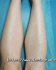 Sugar Lady, студія депбіляції фото