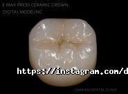 Damian Dental Clinic, стоматологія фото