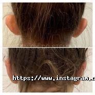 Еталон, центр пластичної хірургії фото