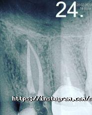 Before & After, стоматологія фото