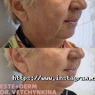 Este+Derm, косметологічна клініка фото