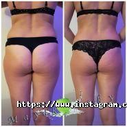 Масажист Денис Маяковський фото