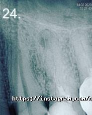 Before & After, стоматологія фото