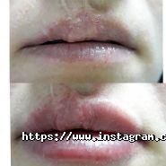 Оксиліон, сімейний центр здоров'я та розвитку фото