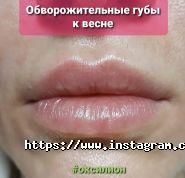 Оксиліон, сімейний центр здоров'я та розвитку фото