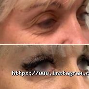 Еталон, центр пластичної хірургії фото