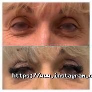 Еталон, центр пластичної хірургії фото