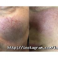 Laser Studio, студія лазерної косметології фото