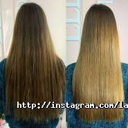 Laser Studio, студія лазерної косметології фото