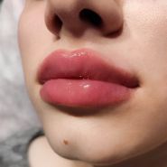 Ляшевська Анна, косметолог фото