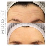 МедЭстет, центр лазерной эпиляции и современной косметологии фото