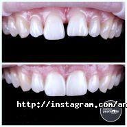 Andreeva PearlSmile, dental spa студія фото