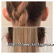 Еталон, центр пластичної хірургії фото