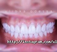 Усмішка, стоматологія фото