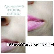 Файна, школа-студія лазерної епбіляції фото