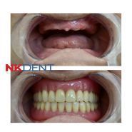NKDent, стоматологія фото