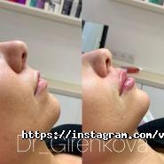 Косметологічний центр Валентини Гиренковой фото