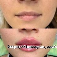 Косметологічний центр Валентини Гиренковой фото