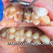 Kalita Dental Studio, стоматологічна майстерня фото