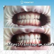 Fdentist, клініка естетичної стоматології фото