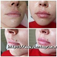 NovaЯ, медична косметологія фото