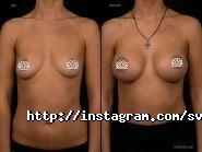 Работенко Світлана Анатоліївна, пластичний хірург фото