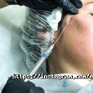 Elast Сosmetology Сlinic, косметологічна клініка фото