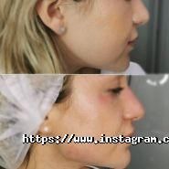 Люменіс, мережа центрів лазерної епіляції та косметології фото