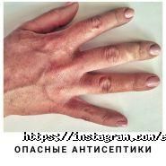 Школа-студія депбіляції та масажу Олени Дутової фото