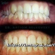 Fdentist, клініка естетичної стоматології фото