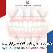 Ruaz-Dent, стоматологическая клиника фото
