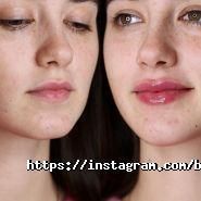 Beauty Med, центр медичної косметології фото