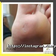 Харитоненко Олена, подолог фото