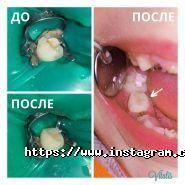 Vitalis, стоматологічна клініка фото