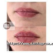 Kormel Esthetique, центр естетичної косметології фото