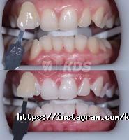 Kalita Dental Studio, стоматологічна майстерня фото