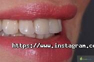 DentaService, стоматология фото